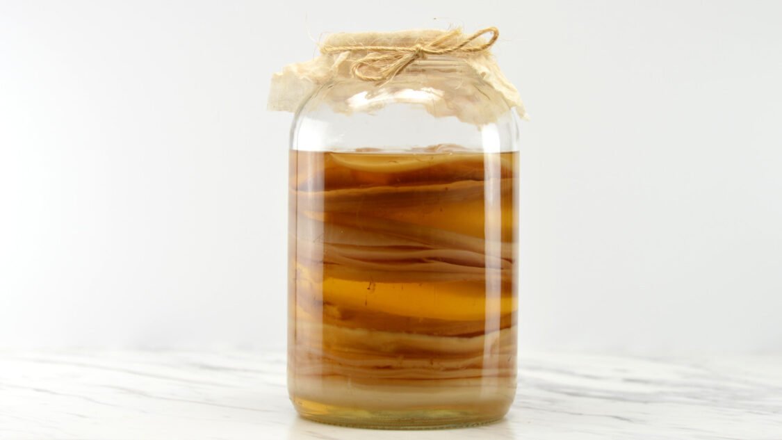 All about SCOBY hotels